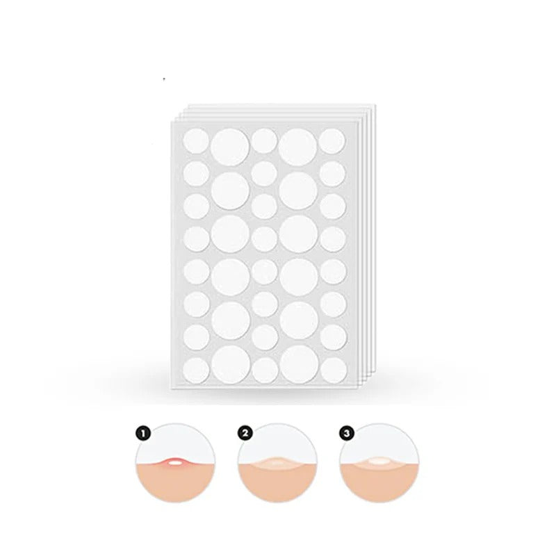 Hydrocolloid Acne Pimple Patch 72 Patches
