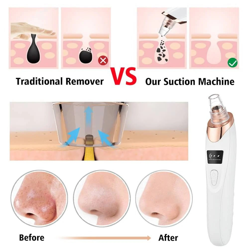 Electric Blackhead Remover Vacuum Pore Cleaner 5 Heads