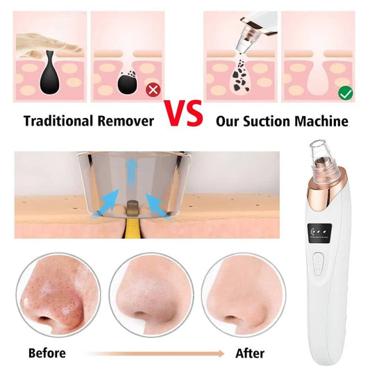 Electric Blackhead Remover Vacuum Pore Cleaner 5 Heads